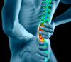 Picture of person with painful lower back pain